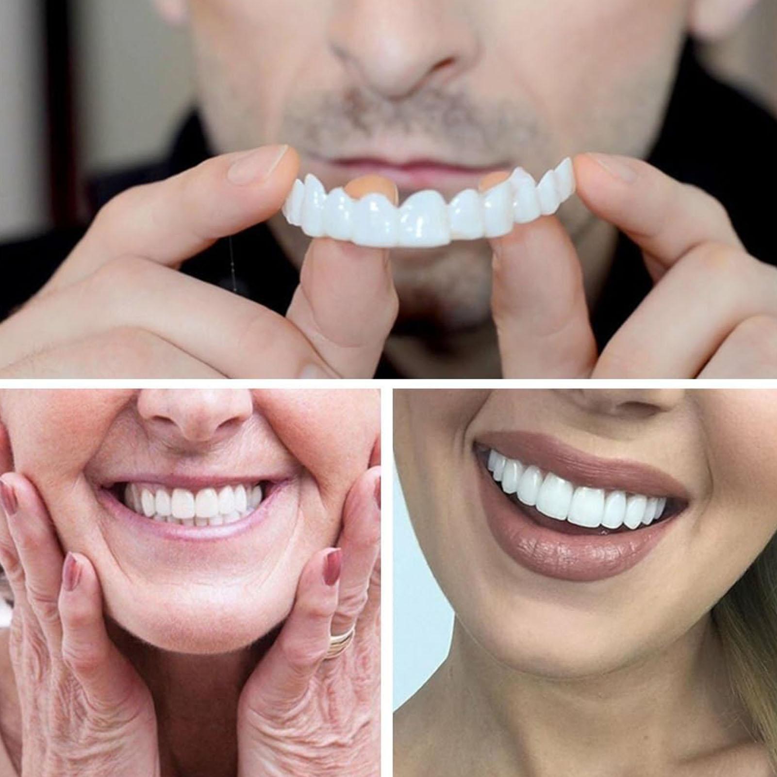 Teeth Whitening In Office - VeneerSnap-on Teeth Kit Fake Temporary Tooth