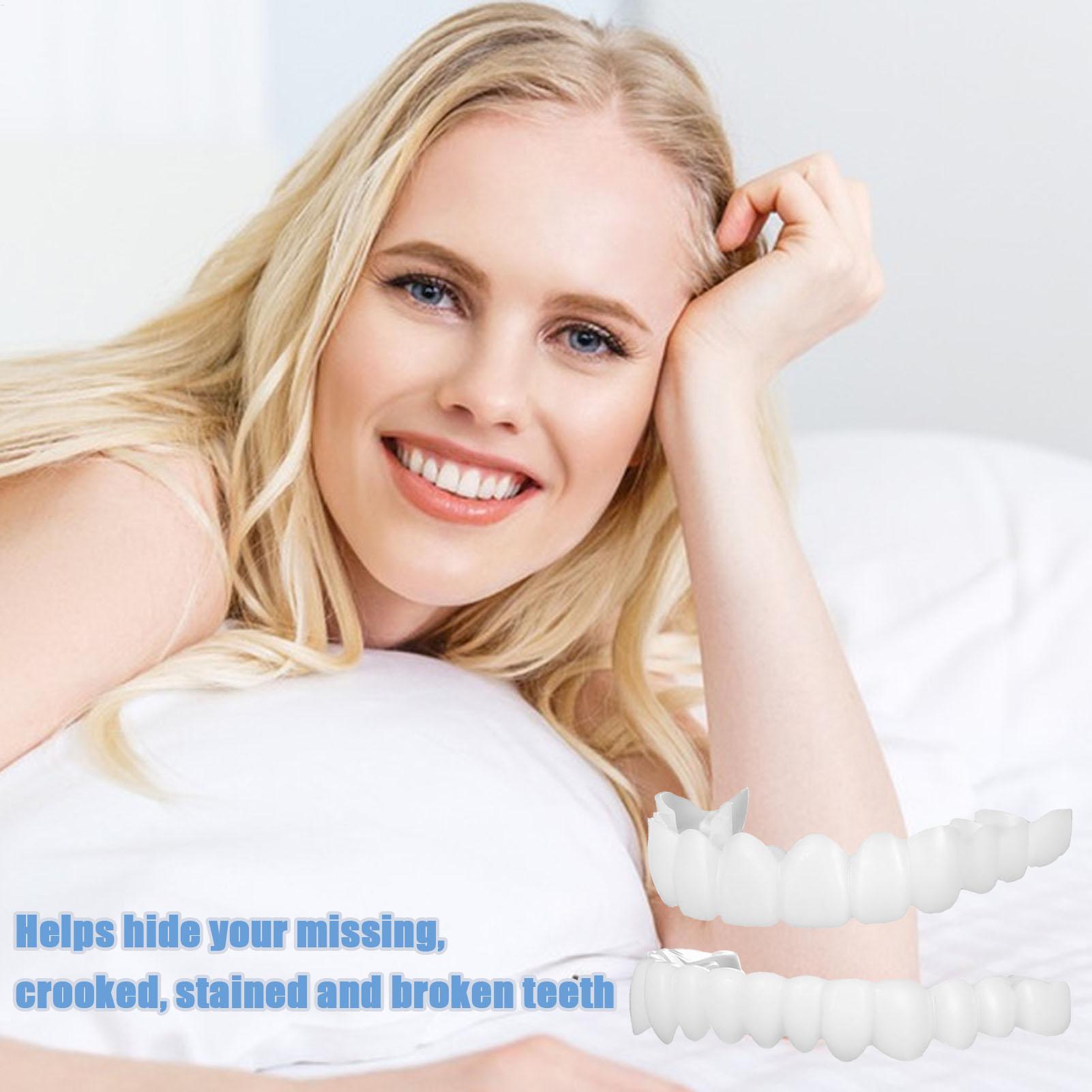 VeneerSnap-on Teeth Kit Fake T - Teeth Whitening In Office 评论和价格