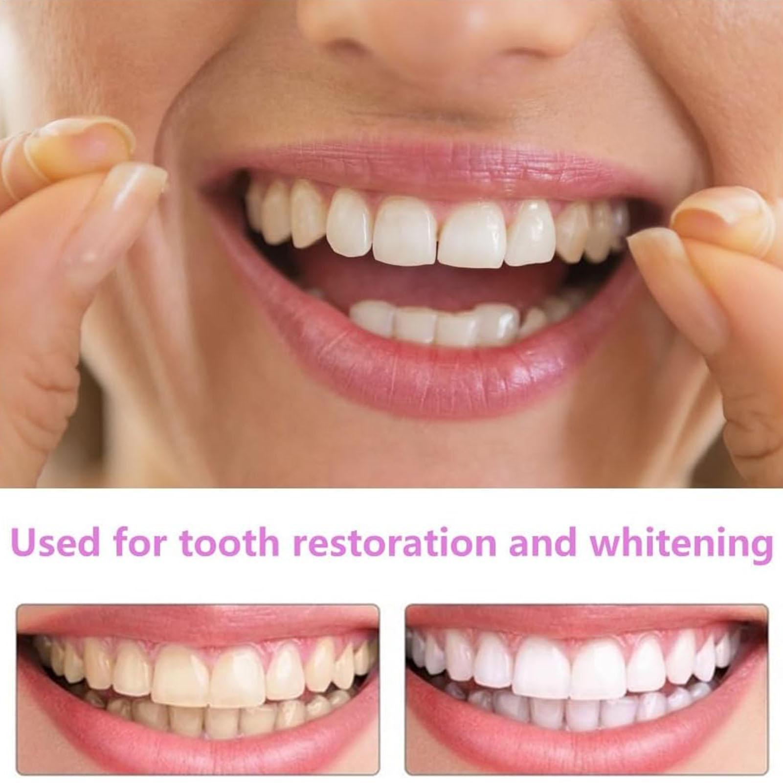 VeneerSnap-on Teeth Kit Fake T - Teeth Whitening In Office 评论和价格