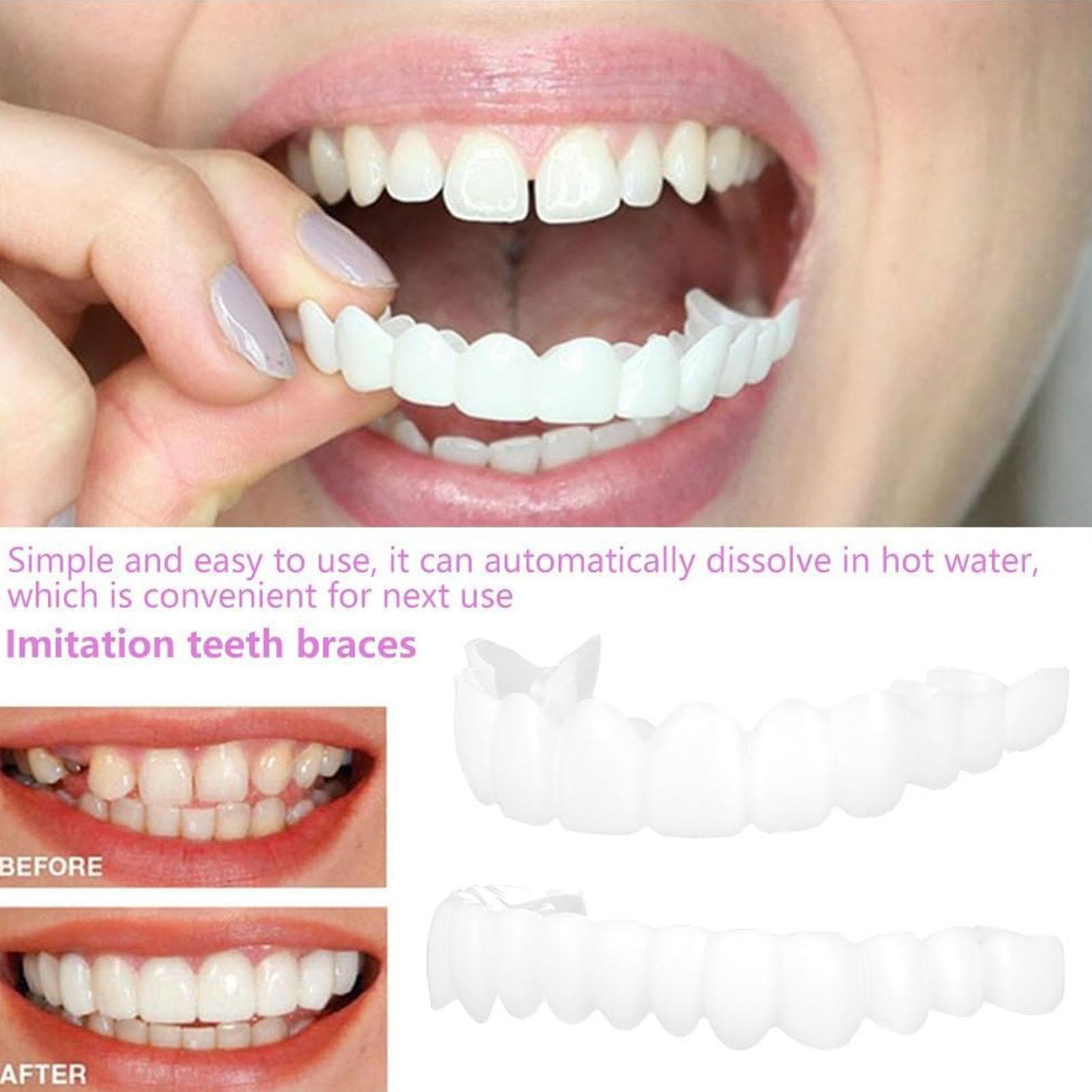 VeneerSnap-on Teeth Kit Fake T - Teeth Whitening In Office 评论和价格
