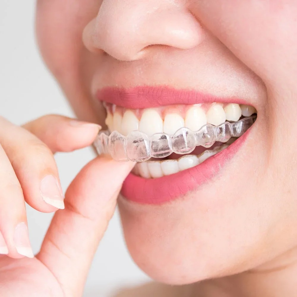 1-4Pc Anti Snoring Bruxism Sle - Dental Guard Night 评论和价格