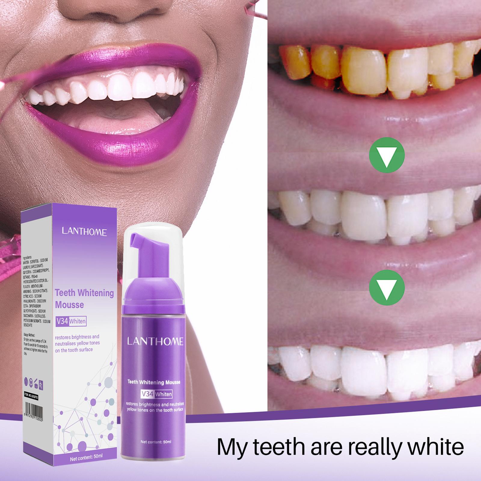 V34 Mousse Teeth Cleaning Toot - Teeth Whitening Yellow Teeth 评论和价格