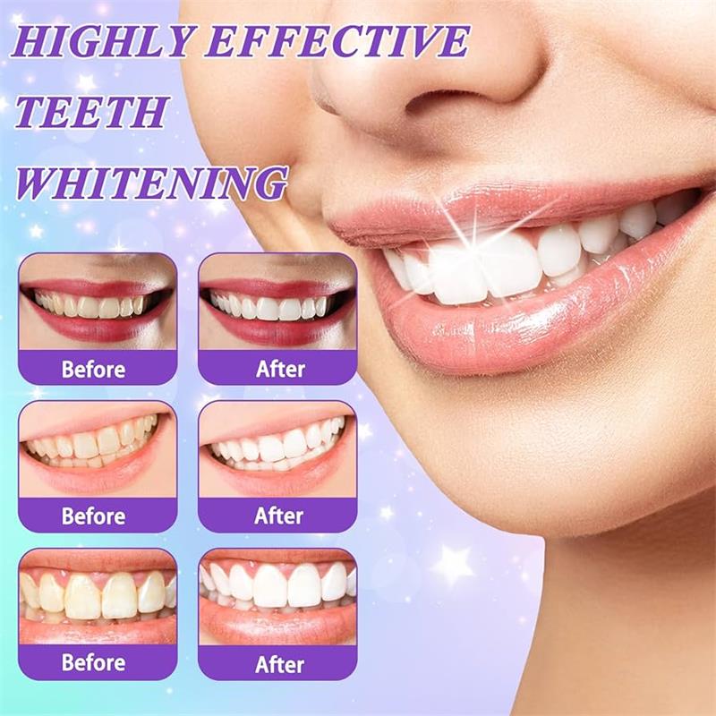 9D Purple Teeth Whitening Toot - Teeth Whitening Yellow Teeth 评论和价格