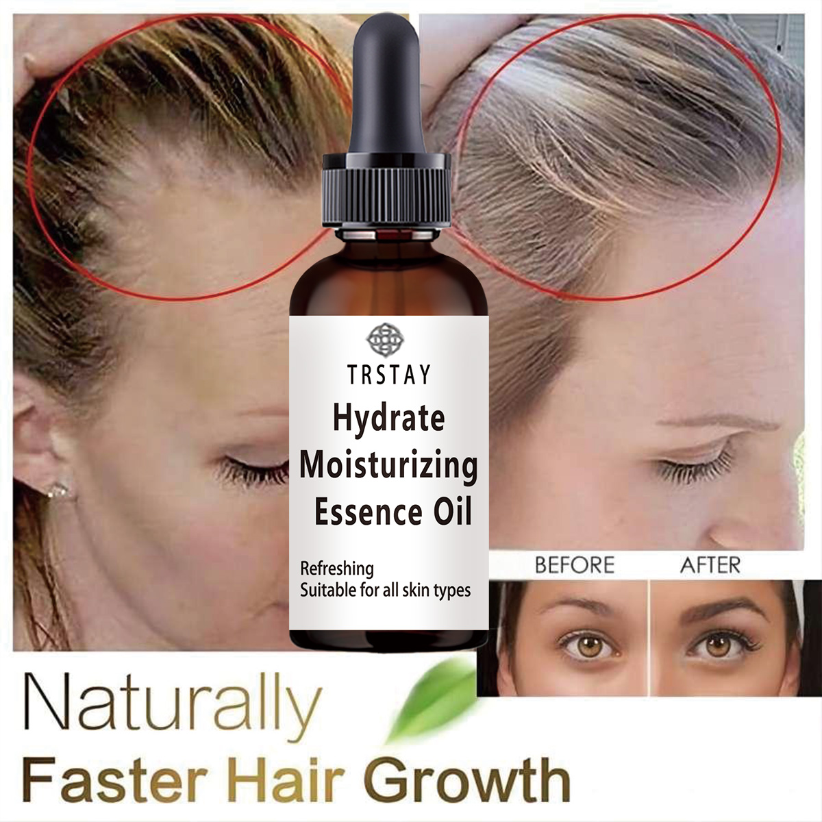 New Castor Oil Hair Growth Ess - Coconut Oil Pull 评论和价格