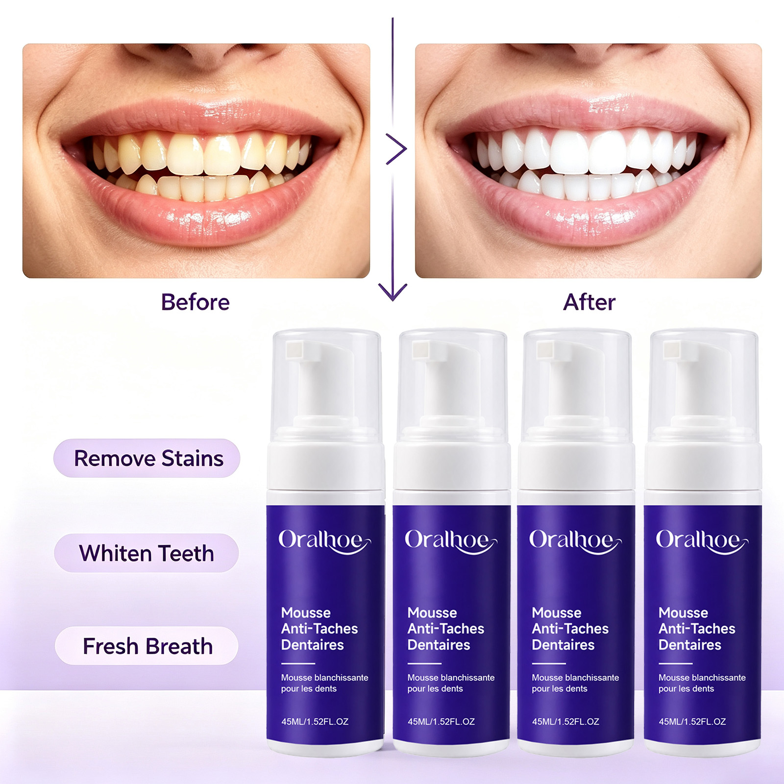 Purple Foaming Teeth Whitening - Teeth Whitening Routine 评论和价格