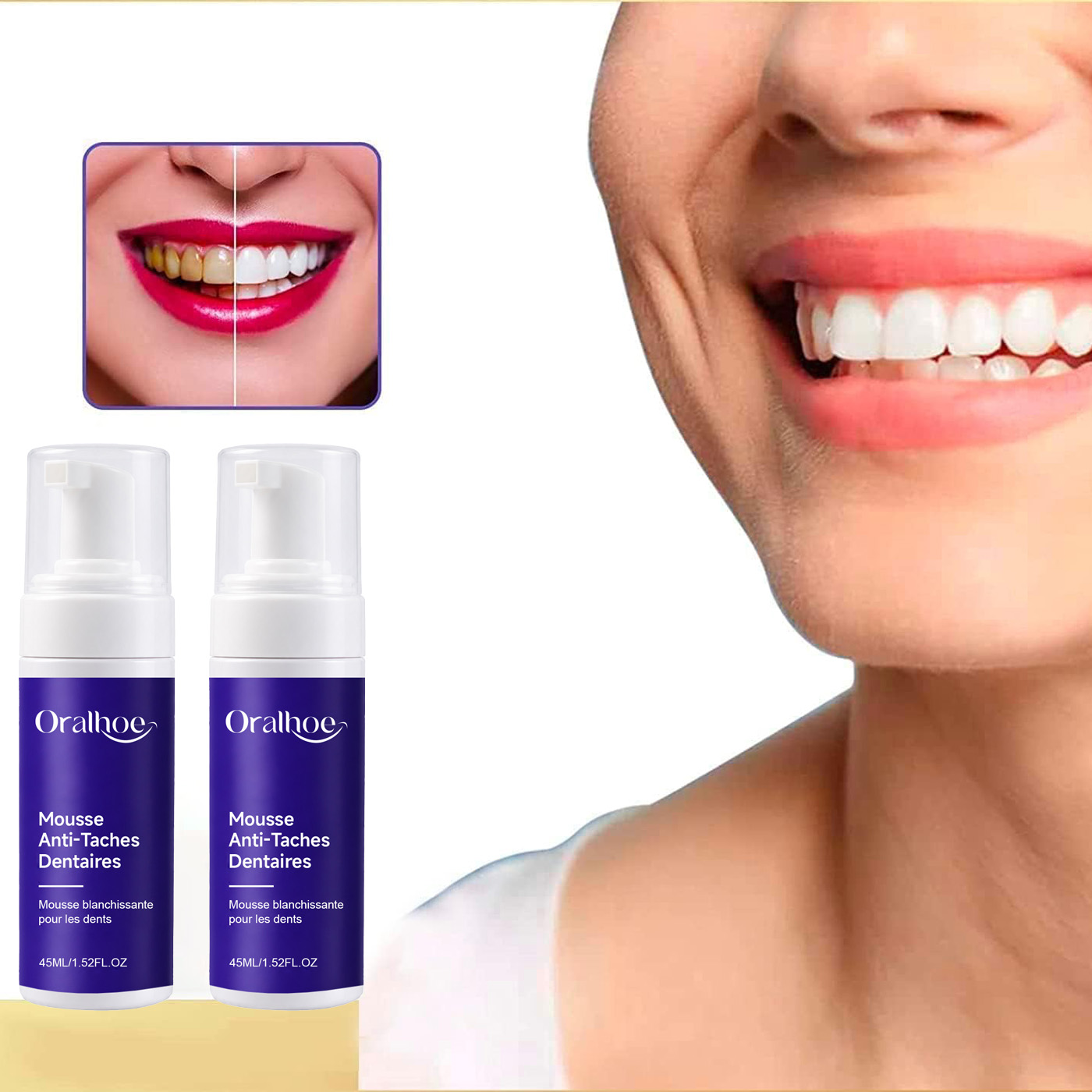 Purple Foaming Teeth Whitening - Teeth Whitening Routine 评论和价格