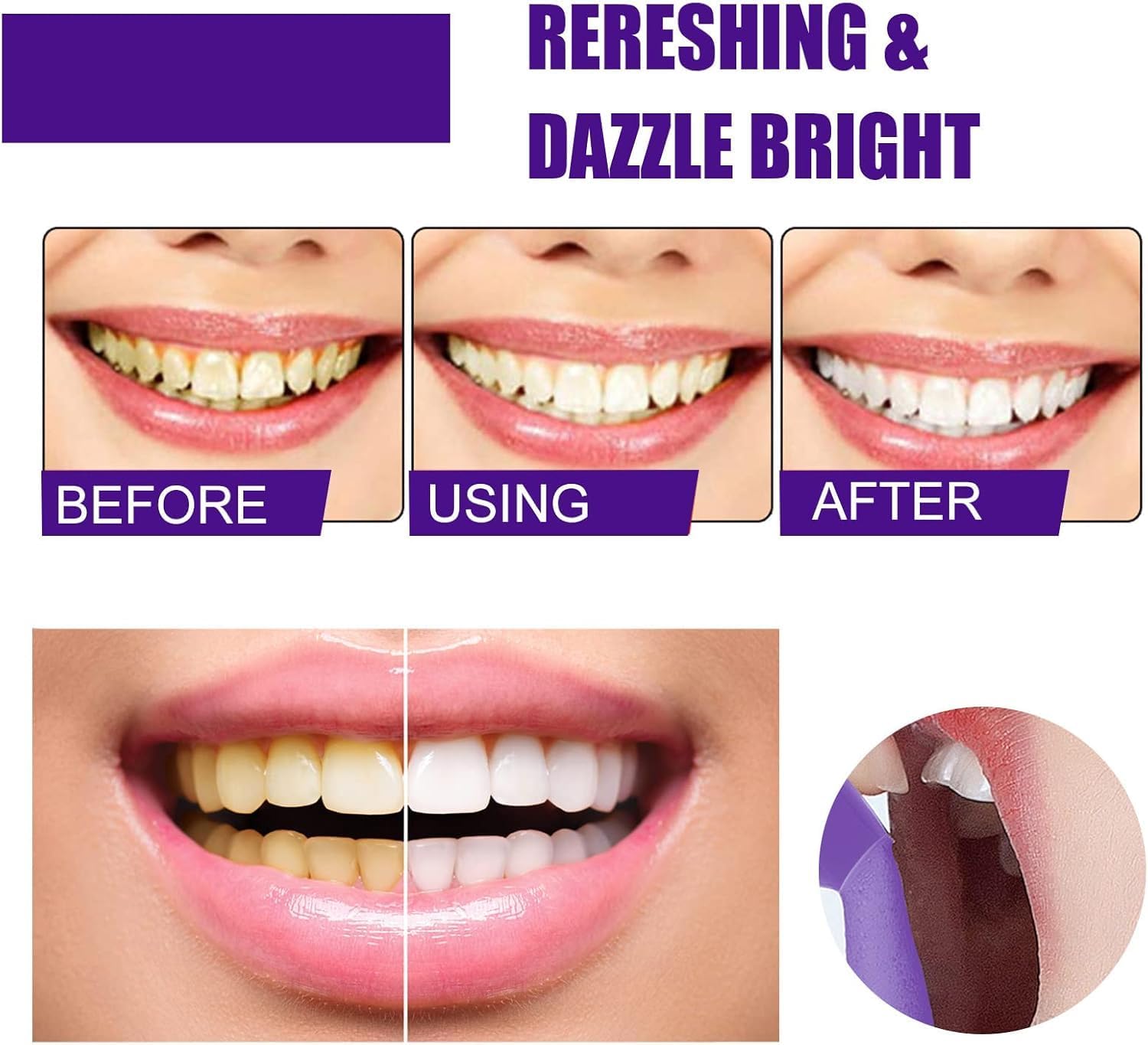 Purple Foaming Teeth Whitening - Teeth Whitening Routine 评论和价格
