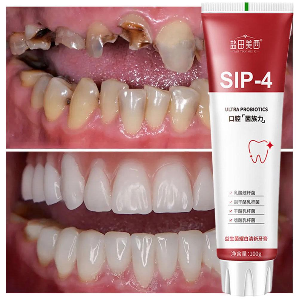 100g Sip-4 Probiotic Whitening - Teeth Whitening Yellow Teeth 评论和价格