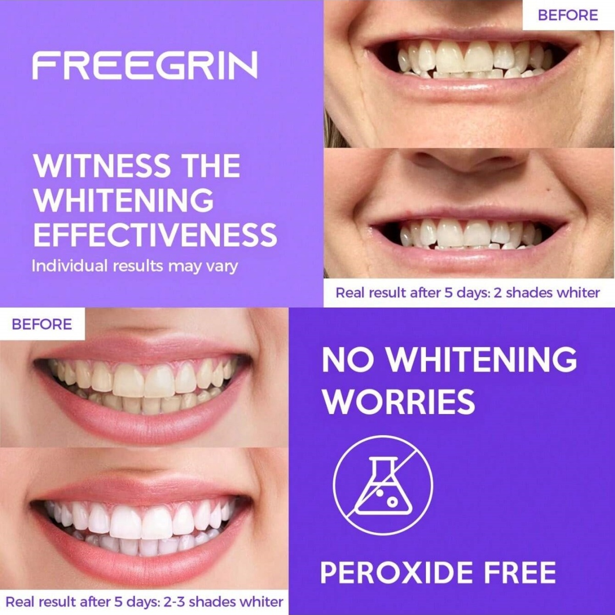 Deluxe Whitening Teeth Sticker - Teeth Whitening In Office 评论和价格
