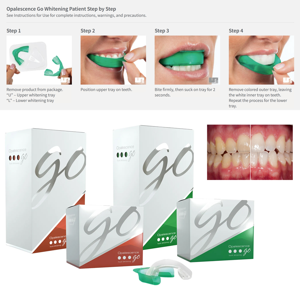 Opalescence Go Teeth Whitening - Teeth Whitening Opalescence Go 评论和价格