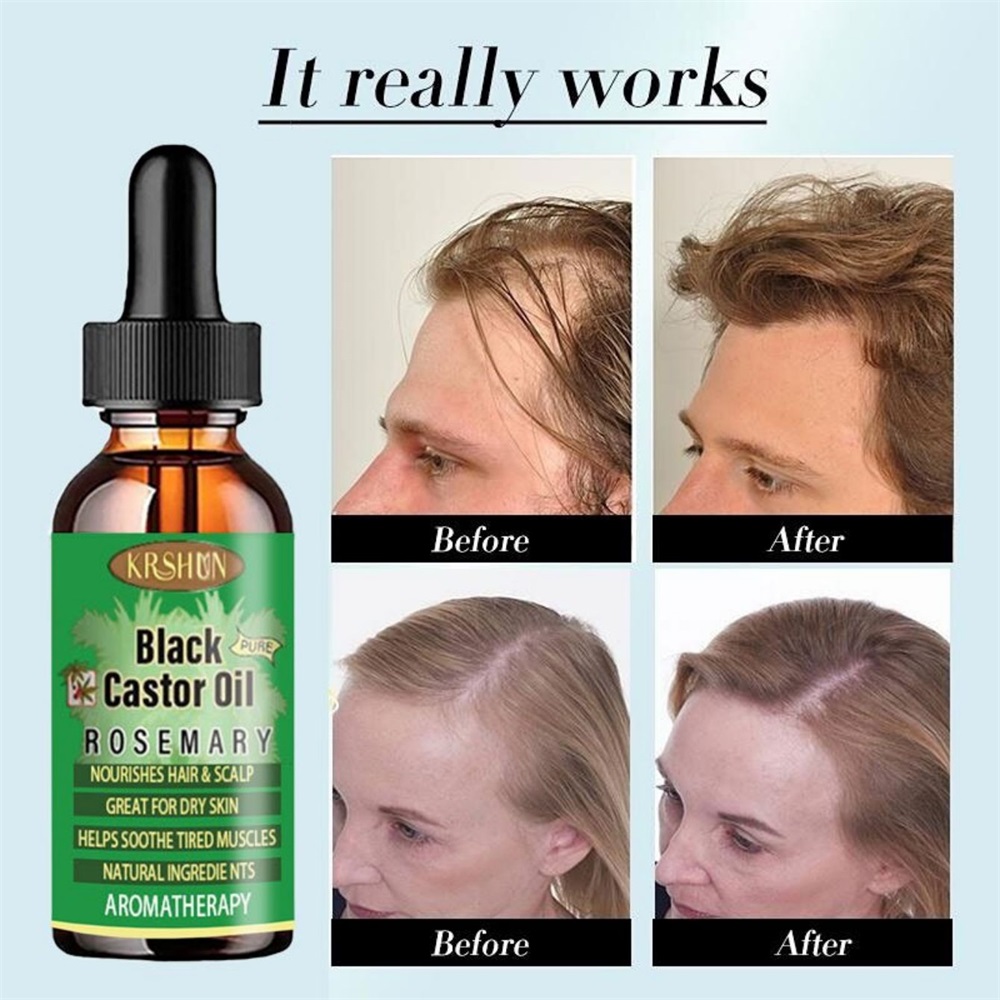 Black Castor Oil Nourishes Hai - Coconut Oil Pull 评论和价格