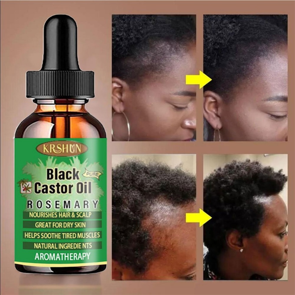 Black Castor Oil Nourishes Hai - Coconut Oil Pull 评论和价格